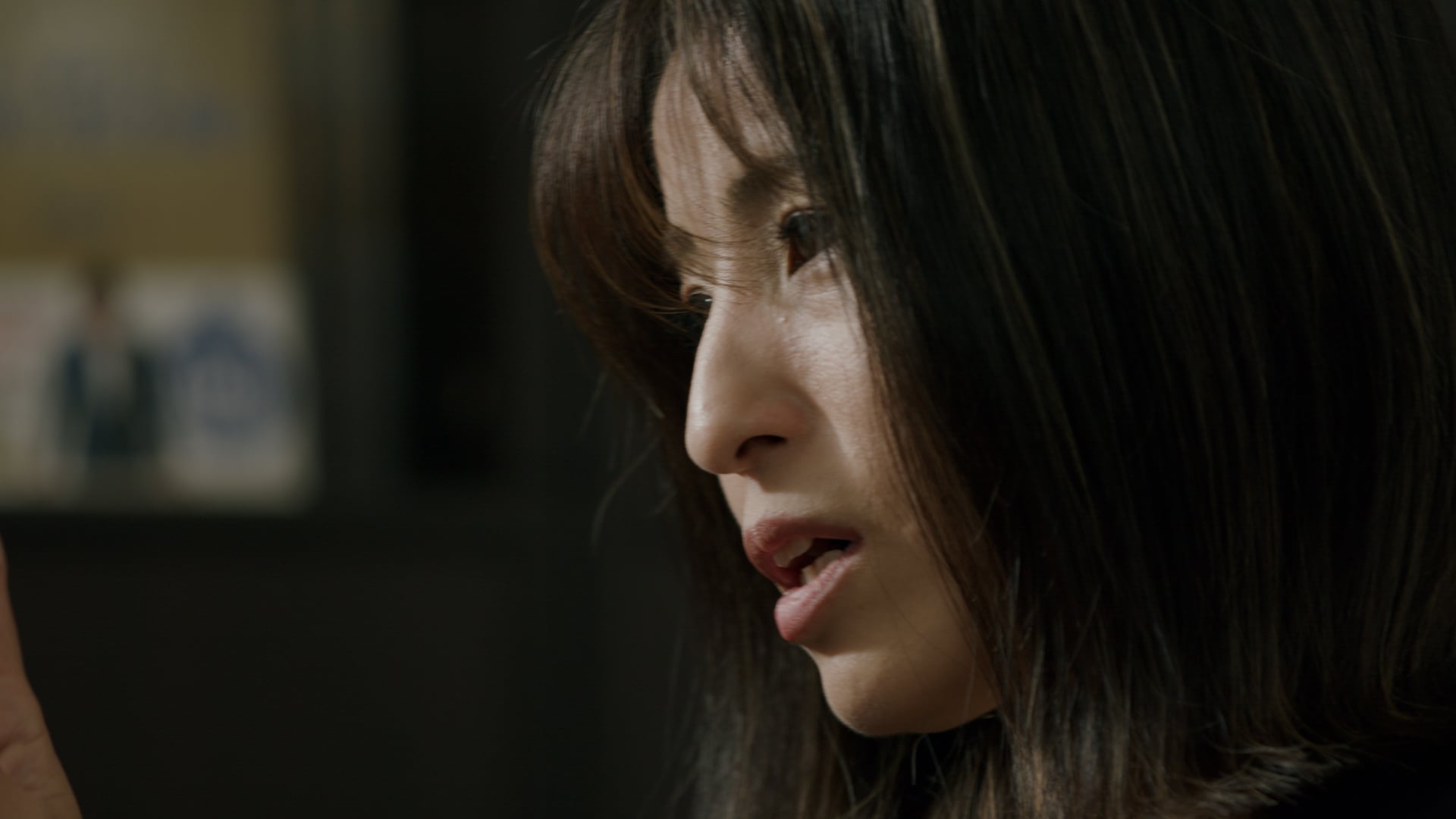 叢状神経線維腫を伴う神経線維腫症 1 型とは何ですか?