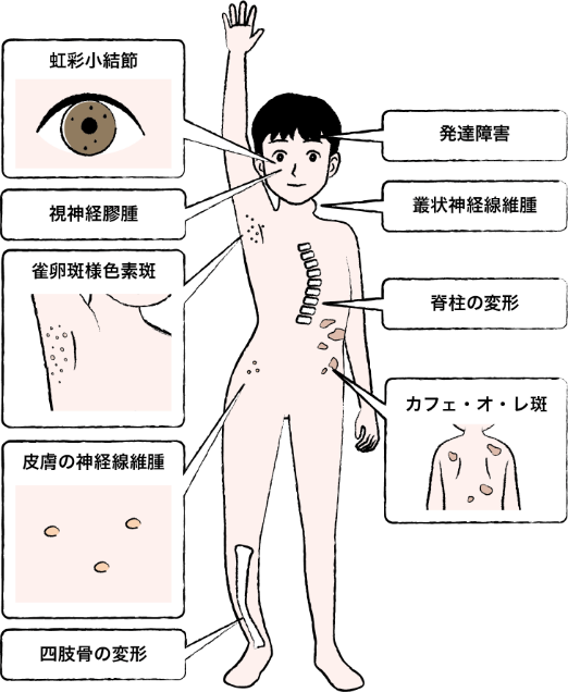 症状の特徴