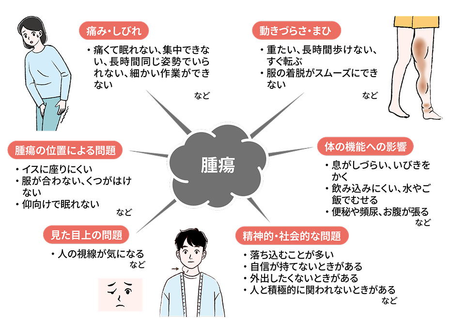 叢状神経線維腫による困りごとの例