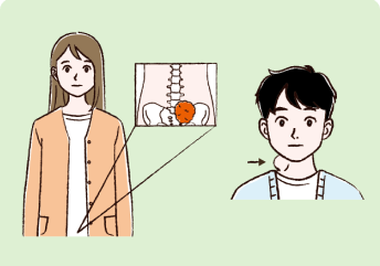 皮膚の表面近くの叢状神経線維腫及び体の奥深くの叢状神経線維腫の絵