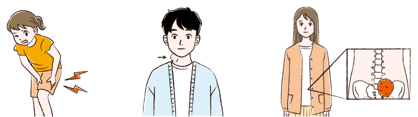 叢状神経線維腫の症状を表したイメージイラスト
足のふともも部分に痛みを感じている小学生の女子イラスト
首の横にコブができている20代男性イラスト
外見上は分からないが、体の中の骨盤に腫瘍ができていることを表している20代女性イラスト