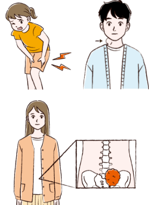 叢状神経線維腫の症状を表したイメージイラスト
足のふともも部分に痛みを感じている小学生の女子イラスト
首の横にコブができている20代男性イラスト
外見上は分からないが、体の中の骨盤に腫瘍ができていることを表している20代女性イラスト