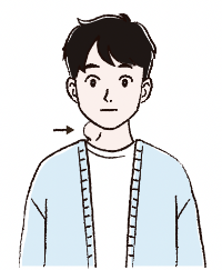 叢状神経線維腫